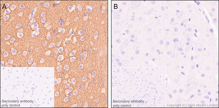Immunohistochemistry (Formalin/PFA-fixed paraffin-embedded sections) - Anti-Rab3A antibody [EPR26022-9] (AB302518)