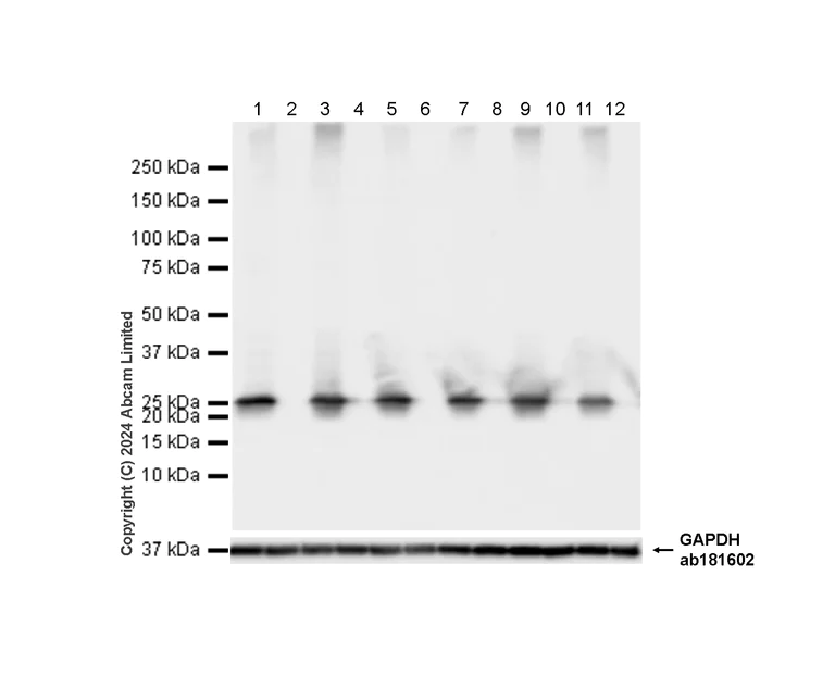 Western blot - Anti-Rab3A antibody [EPR26022-9] (AB302518)