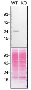 Western blot - Anti-Rab3A antibody [EPR26022-9] (AB302518)