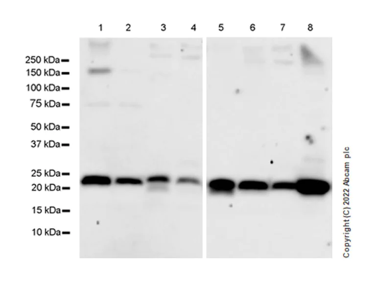 Western blot - Anti-Rab3A antibody [EPR26022-9] (AB302518)