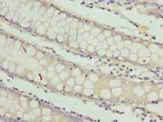 Immunohistochemistry (Formalin/PFA-fixed paraffin-embedded sections) - Anti-RAB3B antibody (AB235518)