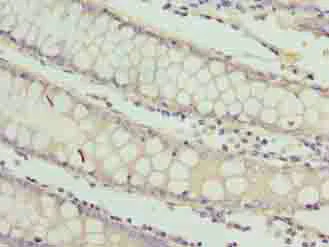 Immunohistochemistry (Formalin/PFA-fixed paraffin-embedded sections) - Anti-RAB3B antibody (AB235518)