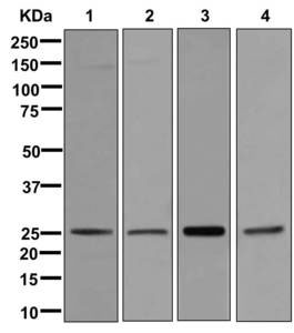 Western blot - Anti-RAB3B antibody [EPR12987] - BSA and Azide free (AB250020), expandable thumbnail
