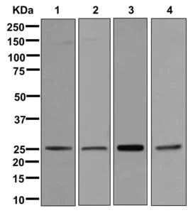 Western blot - Anti-RAB3B antibody [EPR12987] - BSA and Azide free (AB250020)