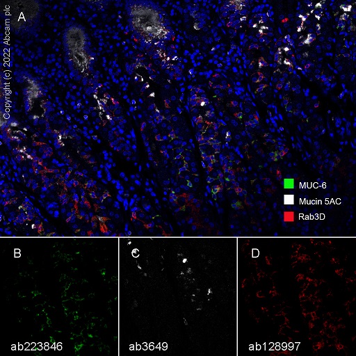 Multiplex immunohistochemistry - Anti-Rab3D antibody [EPR8106] (ab128997), expandable thumbnail