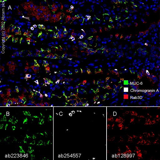 Multiplex immunohistochemistry - Anti-Rab3D antibody [EPR8106] (AB128997), expandable thumbnail