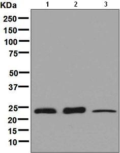 Western blot - Anti-Rab3D antibody [EPR8107] (AB133301)