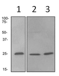 Western blot - Anti-Rab4 antibody [EPR3042] - Early Endosome Marker (AB108974)