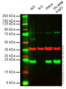 Western blot - Anti-Rab4 antibody [EPR3042] - Early Endosome Marker (AB108974)