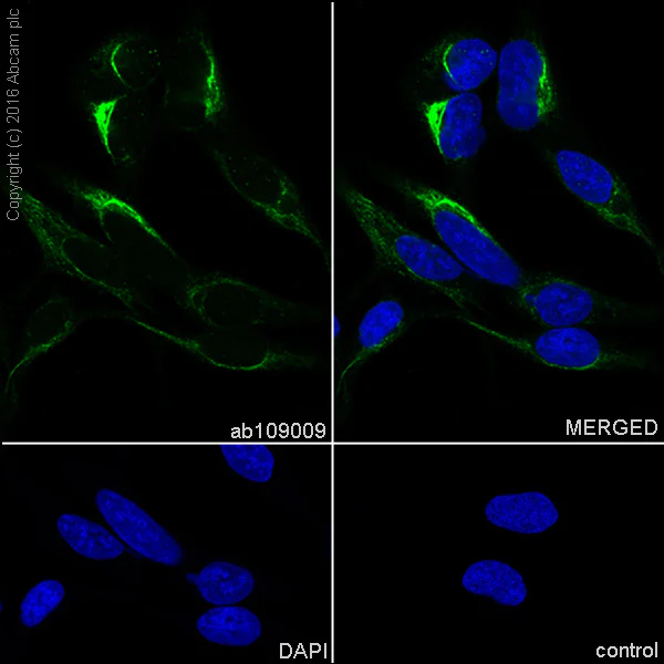 Immunocytochemistry/ Immunofluorescence - Anti-Rab4 antibody [EPR3043] - BSA and Azide free (AB226047)