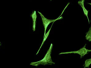 Immunocytochemistry/ Immunofluorescence - Anti-Rab4 antibody [EPR3043] - BSA and Azide free (AB226047)
