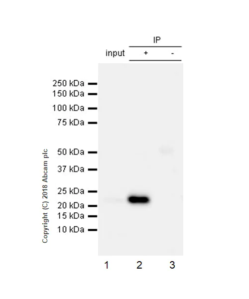 Immunoprecipitation - Anti-Rab4 antibody [EPR3043] - Early Endosome Marker (AB109009)