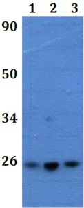 Western blot - Anti-RAB41 antibody (AB201305)