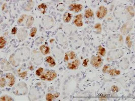 Immunohistochemistry (Formalin/PFA-fixed paraffin-embedded sections) - Anti-RAB43 antibody [5G4] (AB58030)