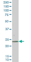 Western blot - Anti-RAB43 antibody [5G4] (AB58030)