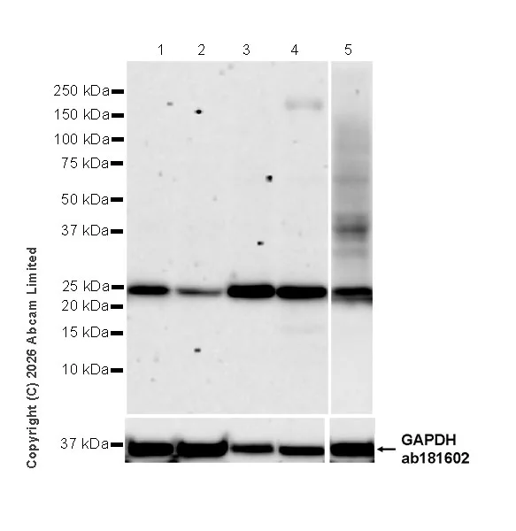 Western blot - Anti-RAB43 antibody [EPR30492-530] - BSA and Azide free (AB326413)
