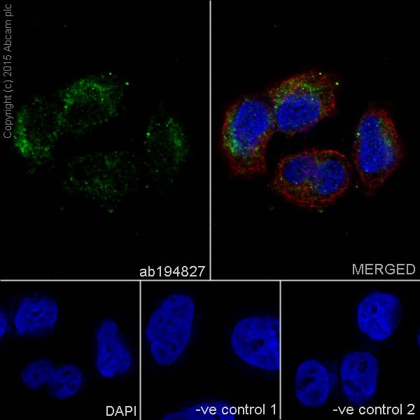 Immunocytochemistry/ Immunofluorescence - Anti-RAB45 antibody [EPR16349] (AB194827), expandable thumbnail