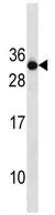 Western blot - Anti-RAB4B antibody - N-terminal (AB179948)