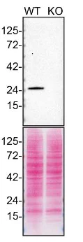 Western blot - Anti-Rab5 antibody [1/Rab5] - Early Endosome Marker (AB288769)