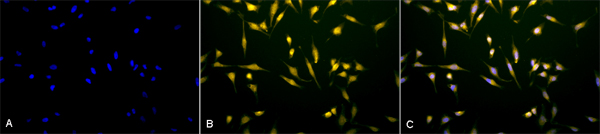 Immunocytochemistry/ Immunofluorescence - Anti-Rab5 antibody (AB13253), expandable thumbnail