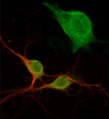 Immunocytochemistry/ Immunofluorescence - Anti-Rab5 antibody (AB13253), expandable thumbnail