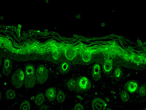 Immunohistochemistry (Formalin/PFA-fixed paraffin-embedded sections) - Anti-Rab5 antibody (AB13253), expandable thumbnail