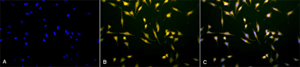 Immunocytochemistry/ Immunofluorescence - Anti-Rab5 antibody - Early Endosome Marker (AB13253)