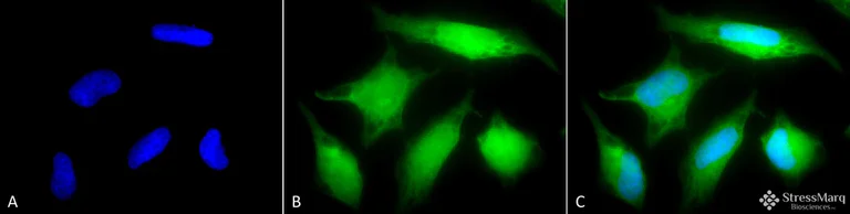 Immunocytochemistry/ Immunofluorescence - Anti-Rab5 antibody - Early Endosome Marker (AB13253)