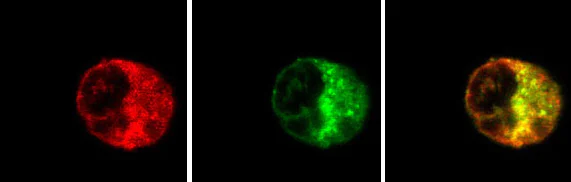 Immunocytochemistry/ Immunofluorescence - Anti-Rab5 antibody - Early Endosome Marker (AB13253)