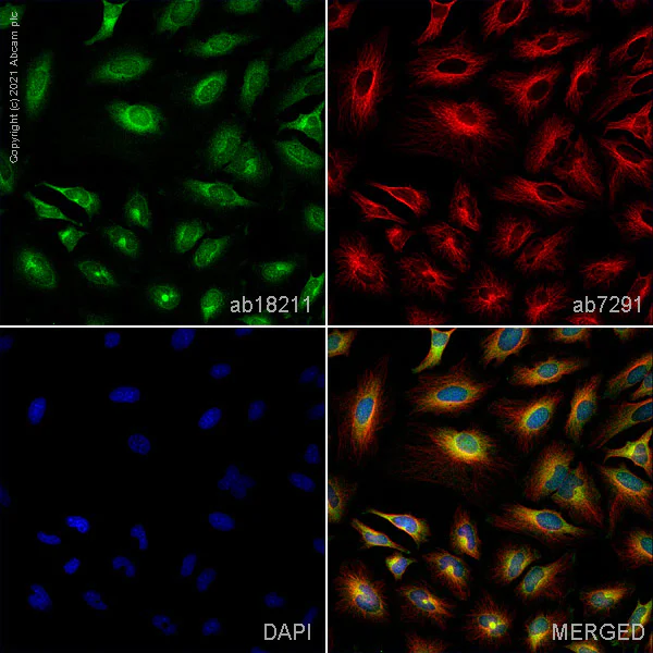 Immunocytochemistry - Anti-Rab5 antibody - Early Endosome Marker (AB18211)