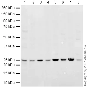 Western blot - Anti-Rab5 antibody - Early Endosome Marker (AB18211)