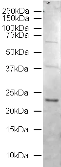 Western blot - Anti-Rab5 antibody - Early Endosome Marker (AB18211)