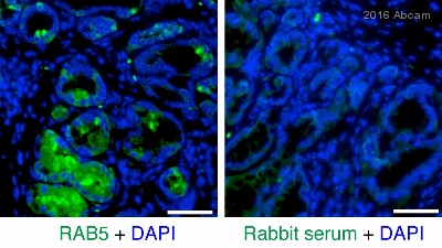 Immunohistochemistry (Formalin/PFA-fixed paraffin-embedded sections) - Anti-Rab5 antibody [EPR5438] - BSA and Azide free (AB234908), expandable thumbnail