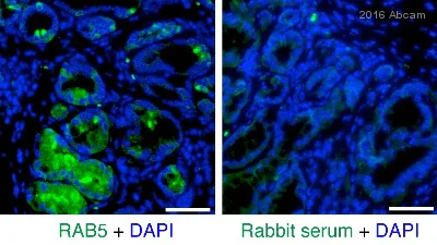 Immunohistochemistry (Formalin/PFA-fixed paraffin-embedded sections) - Anti-Rab5 antibody [EPR5438] - BSA and Azide free (AB234908)