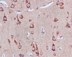 Immunohistochemistry (Formalin/PFA-fixed paraffin-embedded sections) - Anti-Rab5 antibody [EPR5438] - BSA and Azide free (ab234908), expandable thumbnail