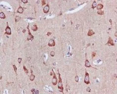 Immunohistochemistry (Formalin/PFA-fixed paraffin-embedded sections) - Anti-Rab5 antibody [EPR5438] - BSA and Azide free (AB234908)