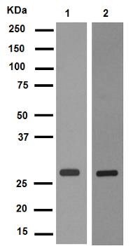Western blot - Anti-Rab5 antibody [EPR5438] - BSA and Azide free (AB234908), expandable thumbnail