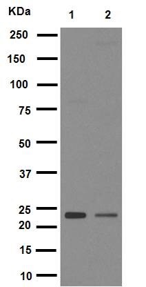 Western blot - Anti-Rab5 antibody [EPR5438] - BSA and Azide free (AB234908), expandable thumbnail