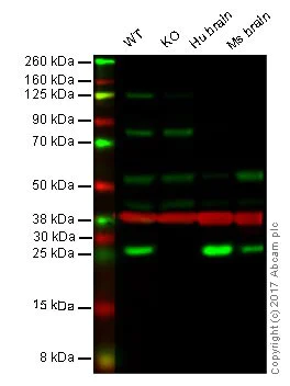 Western blot - Anti-Rab5 antibody [EPR5438] - BSA and Azide free (AB234908)
