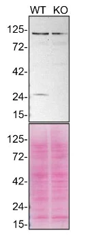 Western blot - Anti-Rab5 antibody [EPR5438] - BSA and Azide free (AB234908)