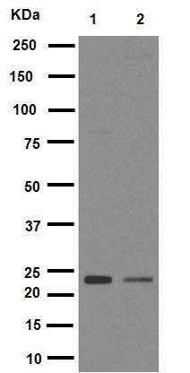 Western blot - Anti-Rab5 antibody [EPR5438] - Early Endosome Marker (AB109534), expandable thumbnail