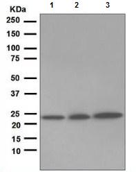 Western blot - Anti-Rab5 antibody [EPR5438] - Early Endosome Marker (ab109534), expandable thumbnail
