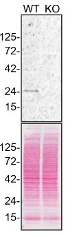 Western blot - Anti-Rab5A antibody [3A4] - Early Endosome Marker (AB66746), expandable thumbnail