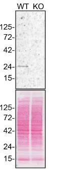 Western blot - Anti-Rab5A antibody [3A4] - Early Endosome Marker (AB66746)