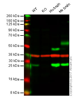 Western blot - Anti-Rab5A antibody [3A4] - Early Endosome Marker (AB66746), expandable thumbnail
