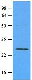 Western blot - Anti-Rab5A antibody [3A4] - Early Endosome Marker (AB66746), expandable thumbnail