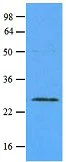 Western blot - Anti-Rab5A antibody [3A4] - Early Endosome Marker (AB66746)