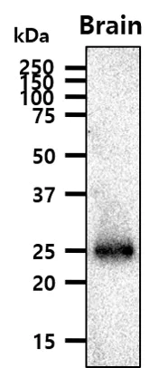 Western blot - Anti-Rab5A antibody [3A4] - Early Endosome Marker (AB66746)