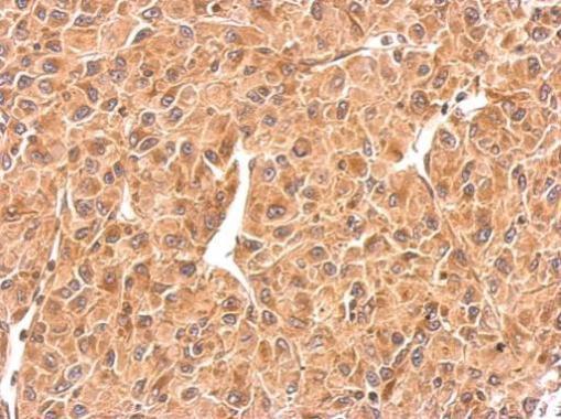 Immunohistochemistry (Formalin/PFA-fixed paraffin-embedded sections) - Anti-Rab5A antibody - C-terminal (AB228770), expandable thumbnail