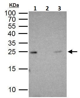 Immunoprecipitation - Anti-Rab5A antibody - C-terminal (AB228770), expandable thumbnail